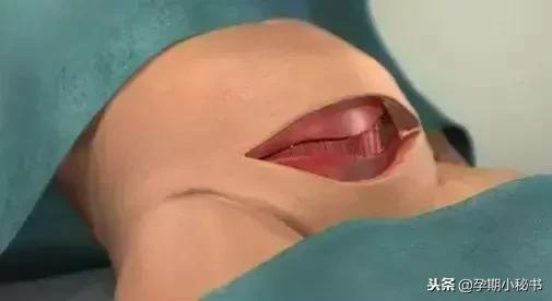 顺产生孩子剖腹产的真实流程,顺产剖腹产生孩子的真实流程