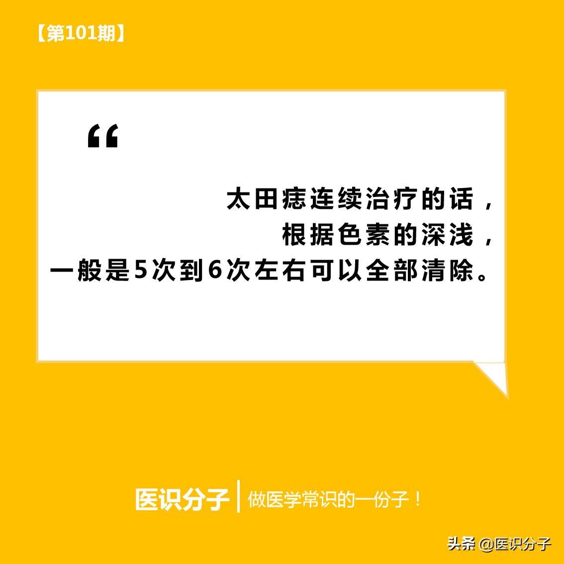 太田痣第二次激光效果,激光治疗颜色较深的太田痣