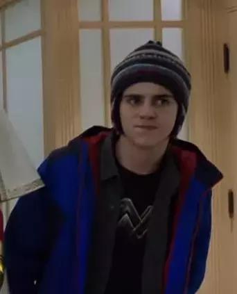 电击脱发,电击治疗斑秃