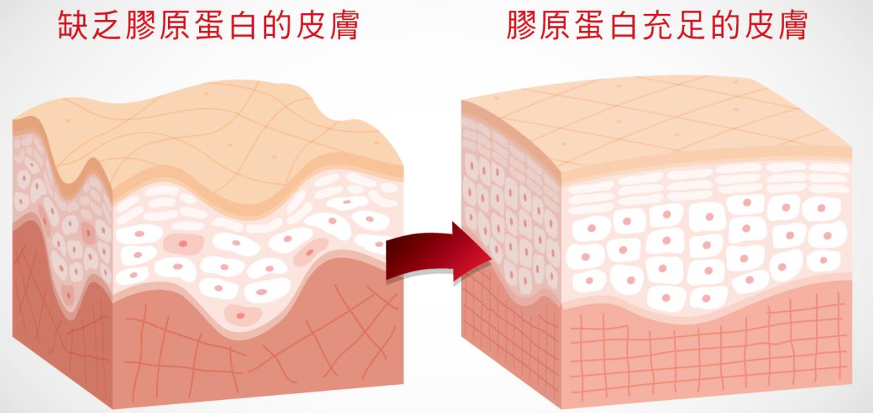法令纹很严重怎么消除不用护肤品,推荐几个去法令纹的有效方法