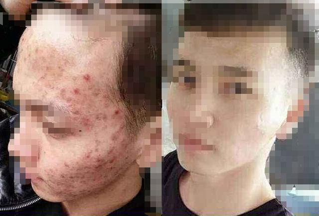 男士洗面奶控油去螨排行榜前十名,洗面奶男士专用控油祛痘深层清洁