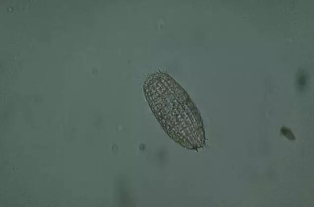 收藏!24种污水处理微生物菌相及指导意义,环保人必看(多图)