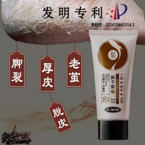 冬天脚跟干裂又起皮怎么办,冬天脚跟干裂起硬皮擦什么保湿好