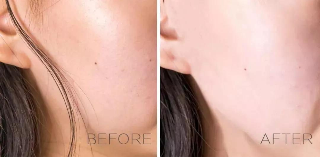 明星都在用的护肤神器,明星都在用的变白神器