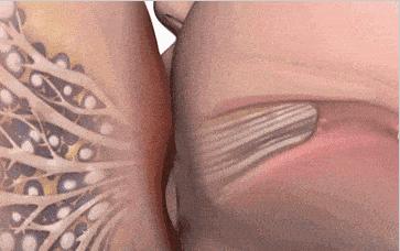 起早贪黑的吸奶还得乳腺炎，医生为你科普：究竟是哪里错了