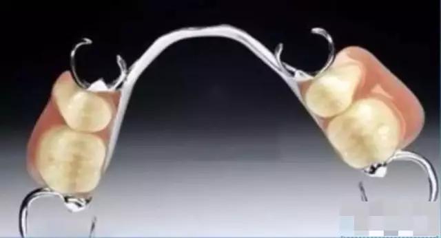 牙科医院是怎么磨小牙齿,牙齿矫正雅悦齿科