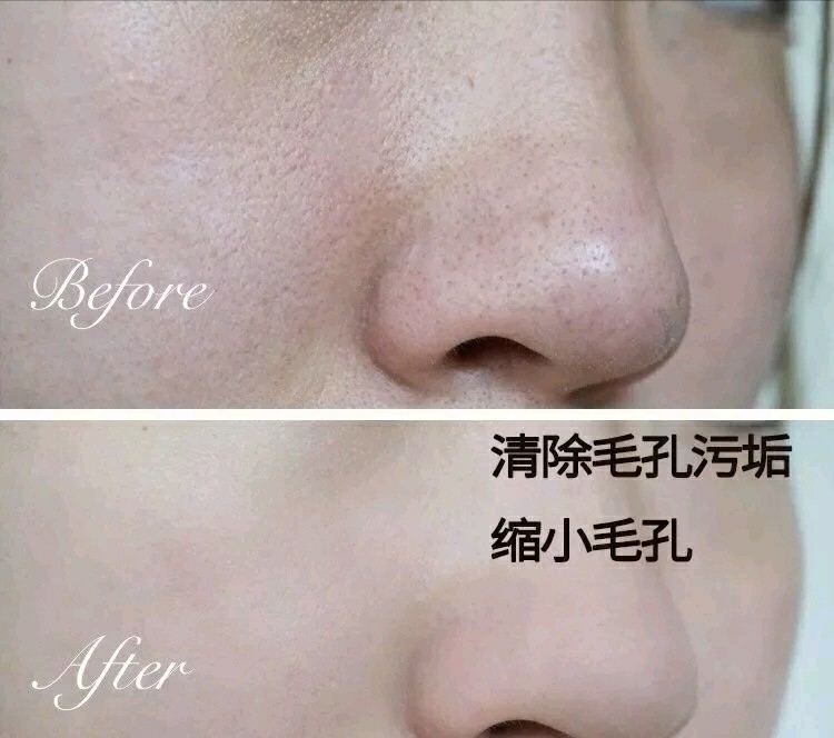 王祖蓝李亚男的护肤品,王祖蓝带货面膜