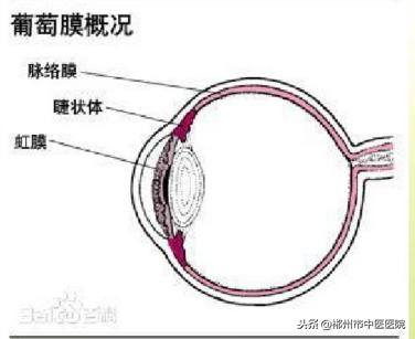 青光眼是不是红眼病,得了红眼病很容易得青光眼吗