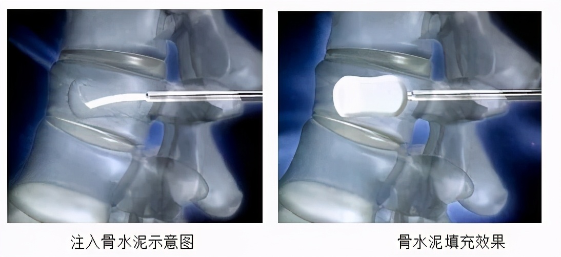 翻身痛坐起来也痛是怎么回事呀,呼吸翻身疼痛是什么原因