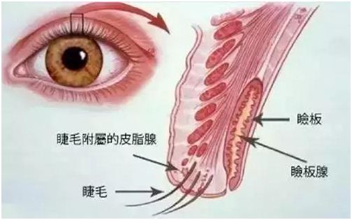 眼睛上长青春痘并且红肿怎么办,眼睛底下长青春痘