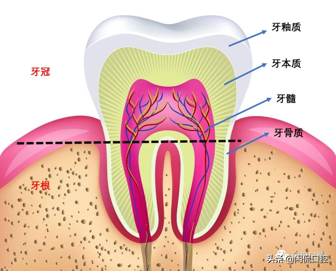 牙齿从中间蛀掉如何治疗,4岁牙齿被蛀空了怎么办