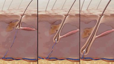 油头救星澳洲茶树洗发水,茶树精油酸性顺滑洗发水
