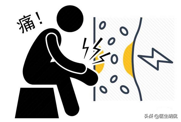 腰痛的大喊是肾结石么,感觉腰痛就是肾有问题了吗