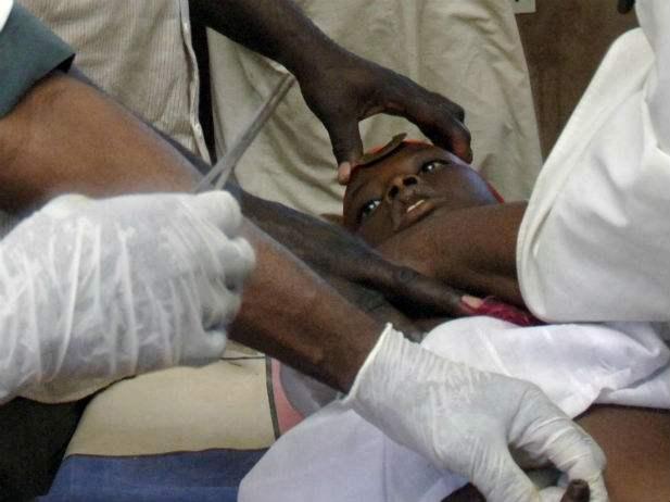 非洲最野蛮的陋俗，新娘为向丈夫表忠心，必须接受割礼