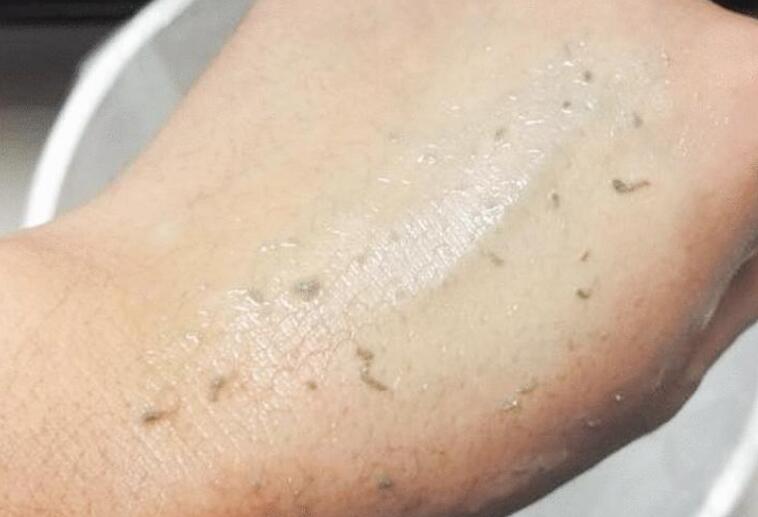 洗澡的时候搓下来的黑泥放大100倍,搓澡下来的黑泥是什么显微镜