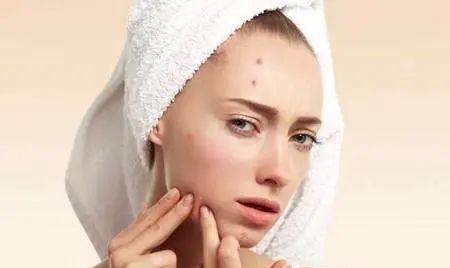 名门泽佳祛痘怎么样,名门泽佳祛痘效果怎么那么好