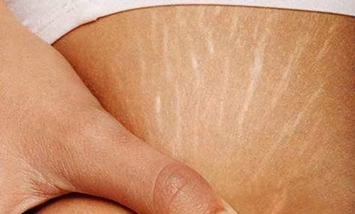 夏日健康大作战,荒野行动夏日活动大作战