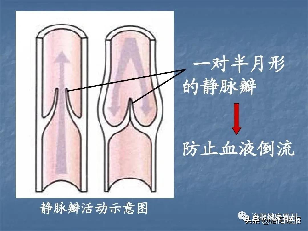 邯郸放血治疗静脉曲张,老李治静脉曲张