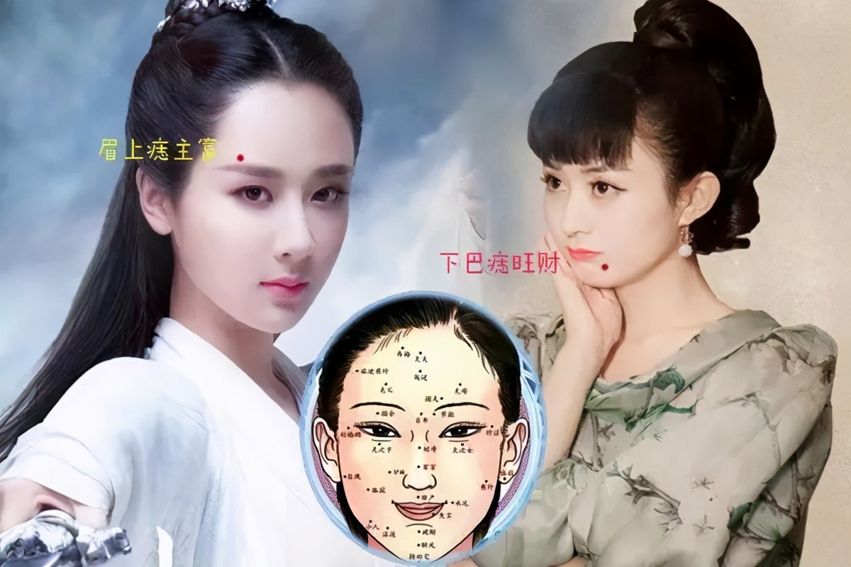 身上的痣颜色为什么不一样,身上长的不同的痣