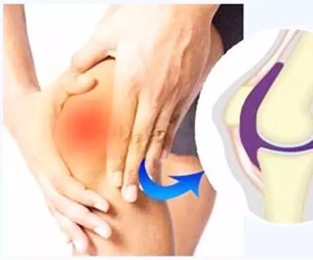 受冷引起的膝盖滑膜炎能自愈吗,膝盖滑膜炎怕冷是什么原因