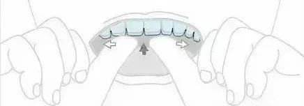 嫌隐形牙套难摘戴？那是你的姿势不正确