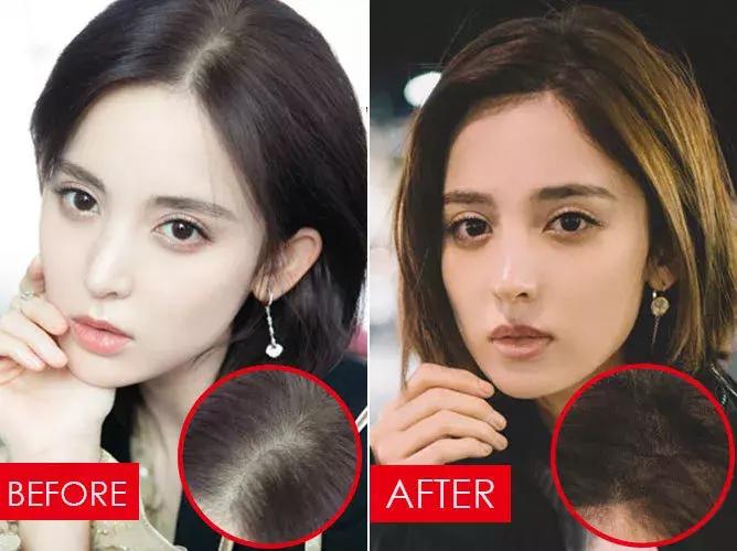 张歆艺防止妊娠纹,张歆艺预防妊娠纹