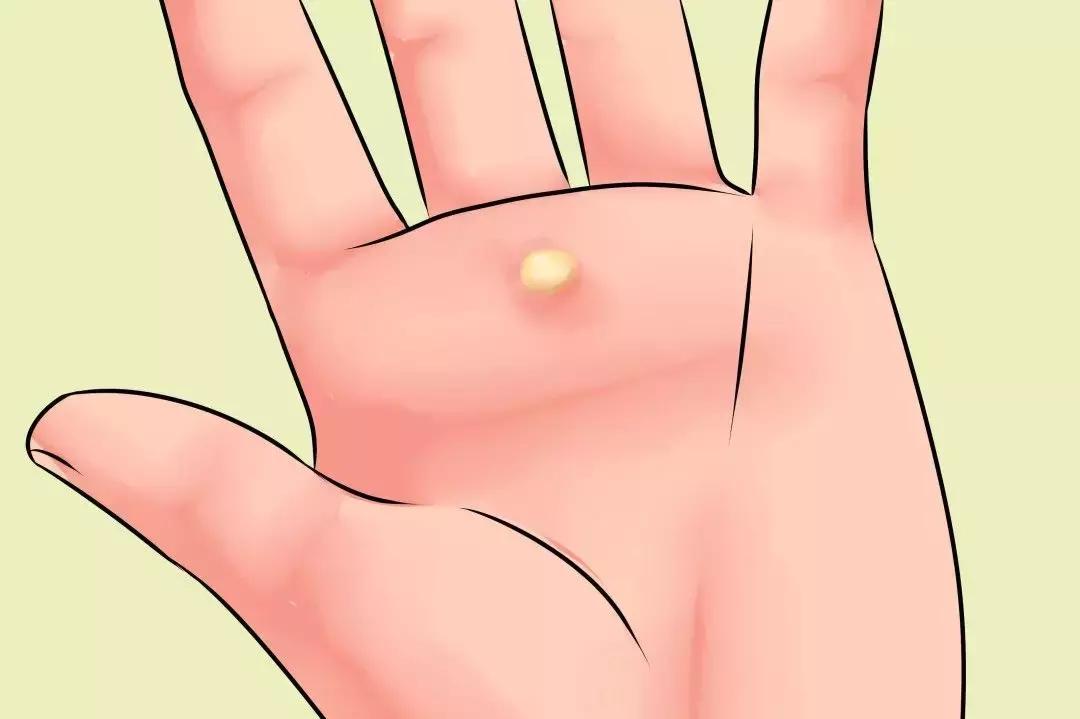 烧伤常见的护理诊断,常见的烧伤医疗诊断方法有哪些