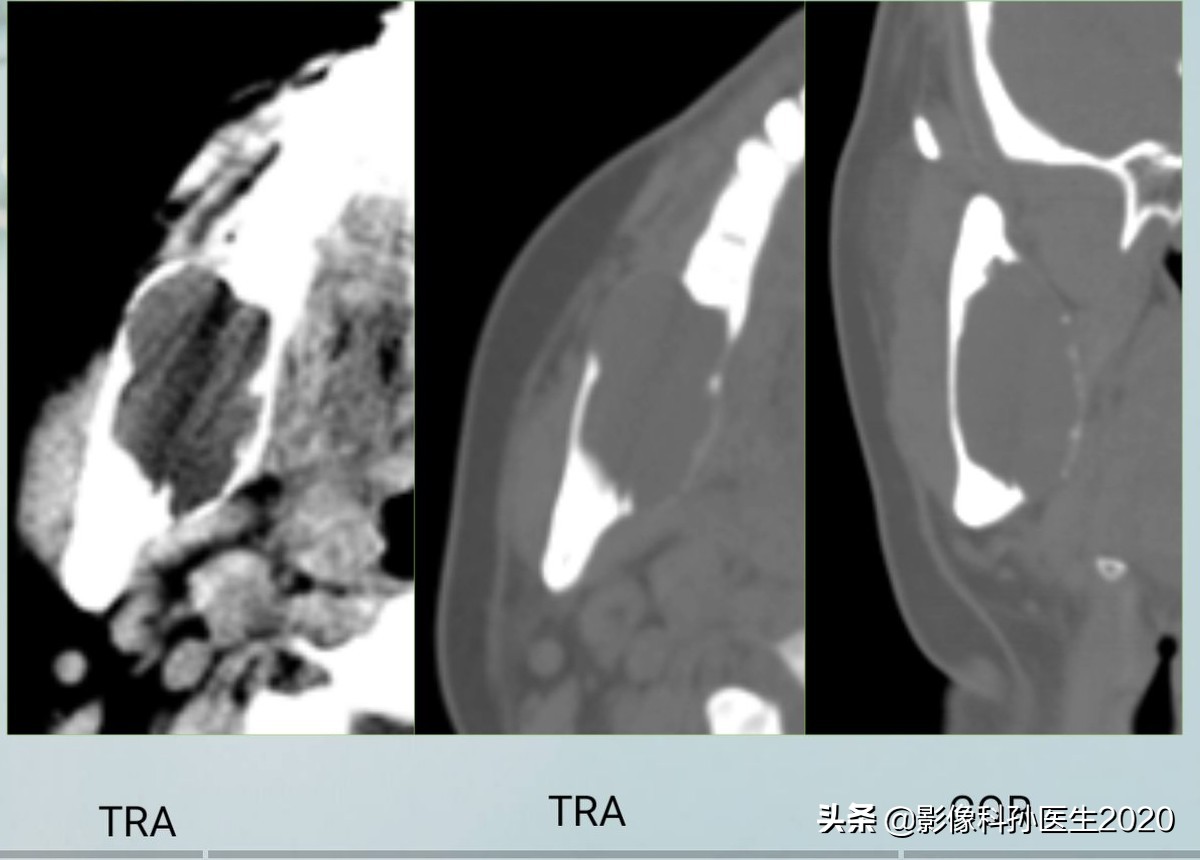 case10什么意思,case案例合集