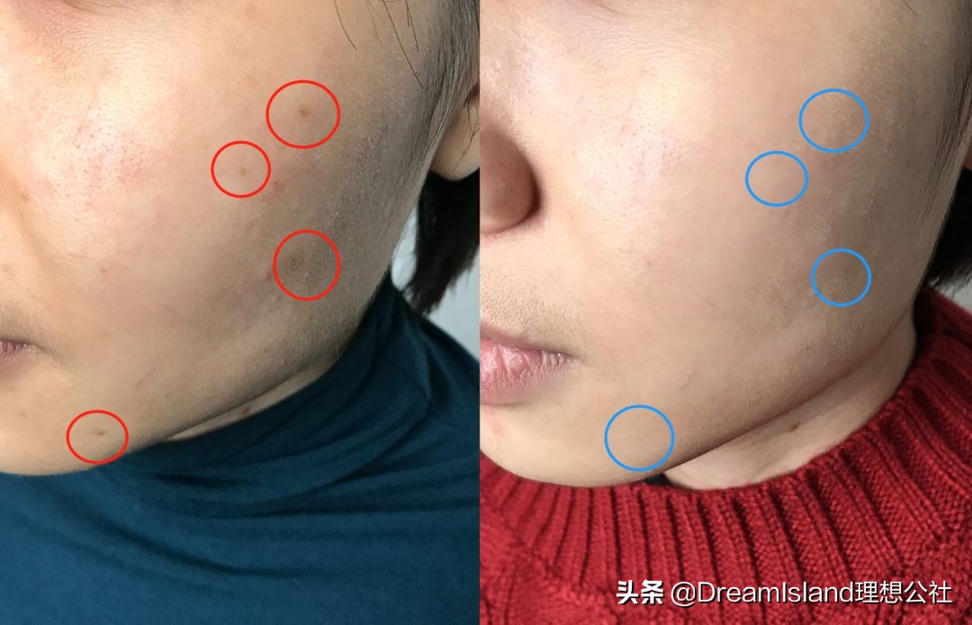 皮肤太白会不会有问题,皮肤太白涂什么好