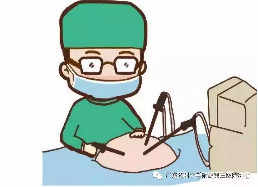 消融法治疗恶性肿瘤的疗效,消融术是消融良性还是恶性肿瘤