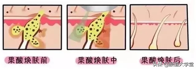 运动可以让脸上皮肤变好吗,脸上敷什么可以让皮肤变好