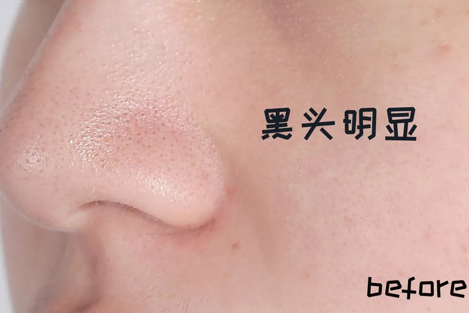 邓紫棋推荐的补水步骤 (邓紫棋使用什么粉底色好)