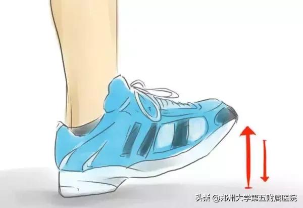 孕期下肢静脉血栓孩子真不能要吗,孕期下肢血栓的症状有哪些