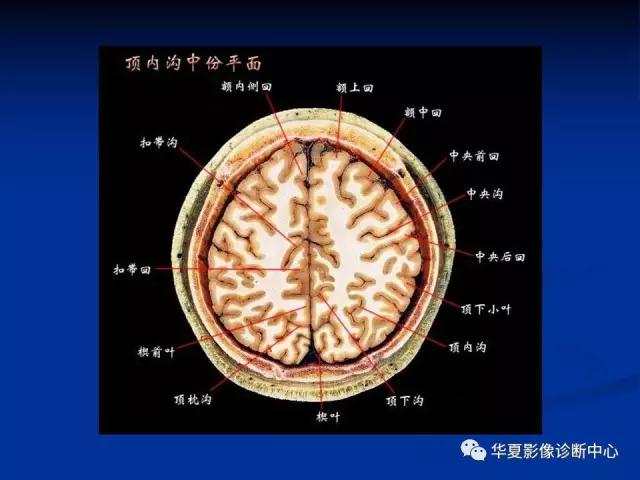 电子版头颅ct与mri断层解剖,头颅mri血管解剖与分段详解
