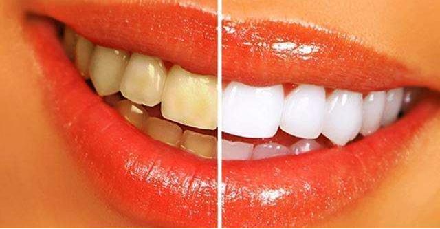 牙缝里黄黄的硬的,牙缝里臭臭的黄泥