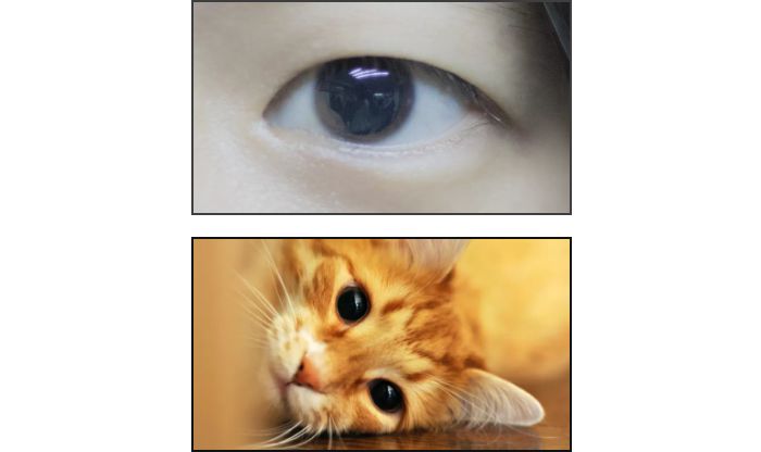 激光近视手术后的恢复过程,激光近视手术超越常识的后遗症