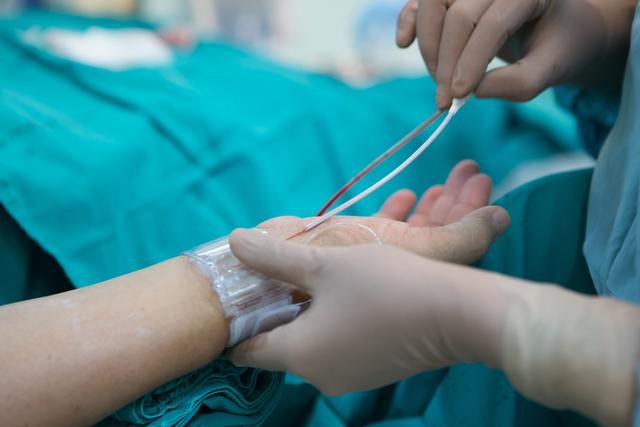 冠心病造影和心梗造影一样吗,查出冠心病有必要做心脏造影吗