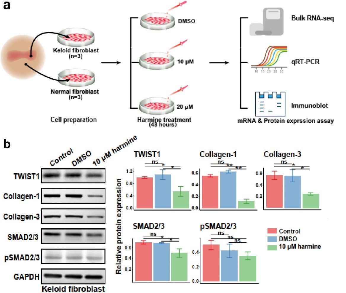 瘢痕疙瘩发病原因,皮肤瘢痕症