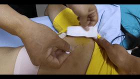 如何快速治肩颈痛,长期低头颈肩疼怎么治