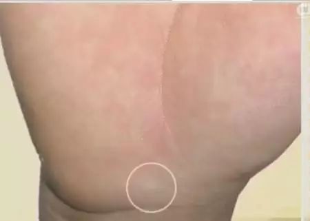 手上出现这些变化可能是疾病信号,手的颜色能看出健康的问题吗