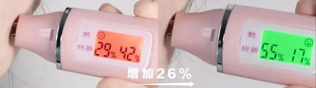 医美收毛孔价格表,医美收毛孔什么方法好