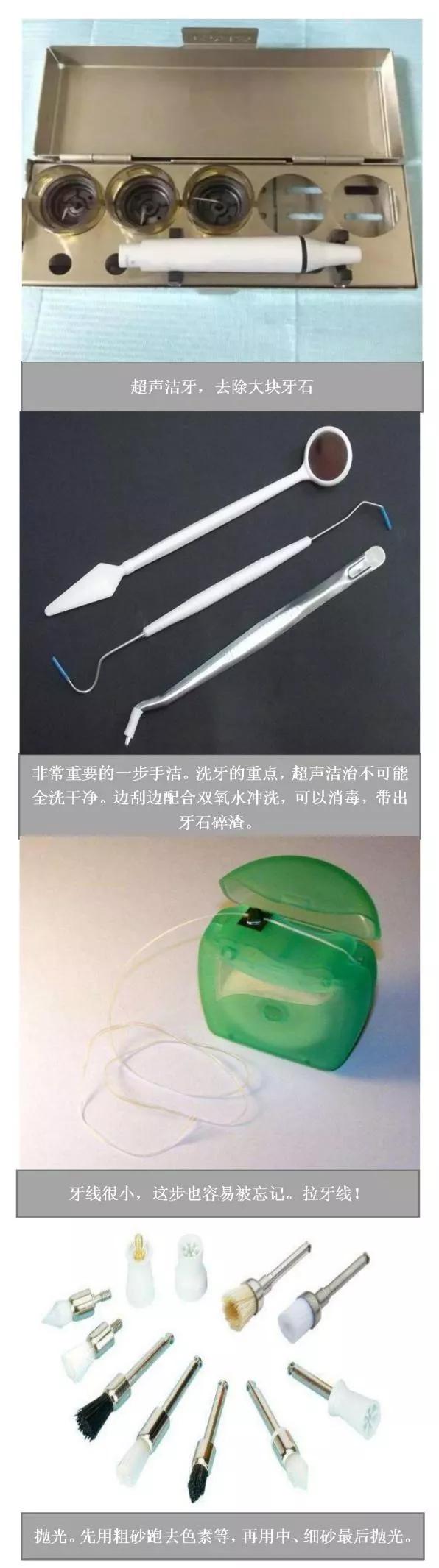Helen齿科中心——口腔健康，从保卫牙周做起