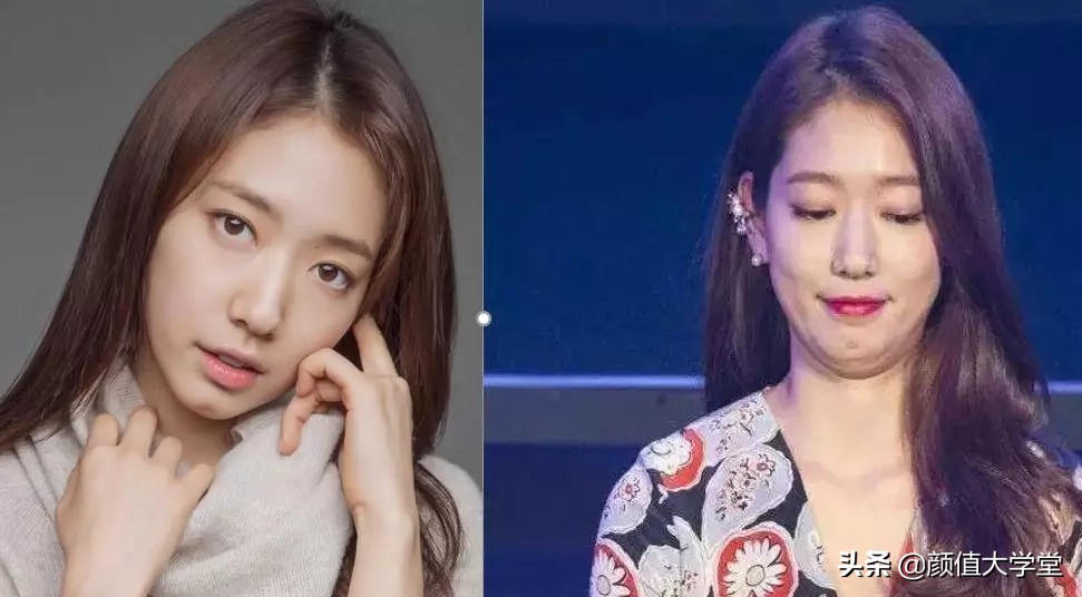 下巴后缩怎么拍侧颜,下巴后缩需要怎么矫正