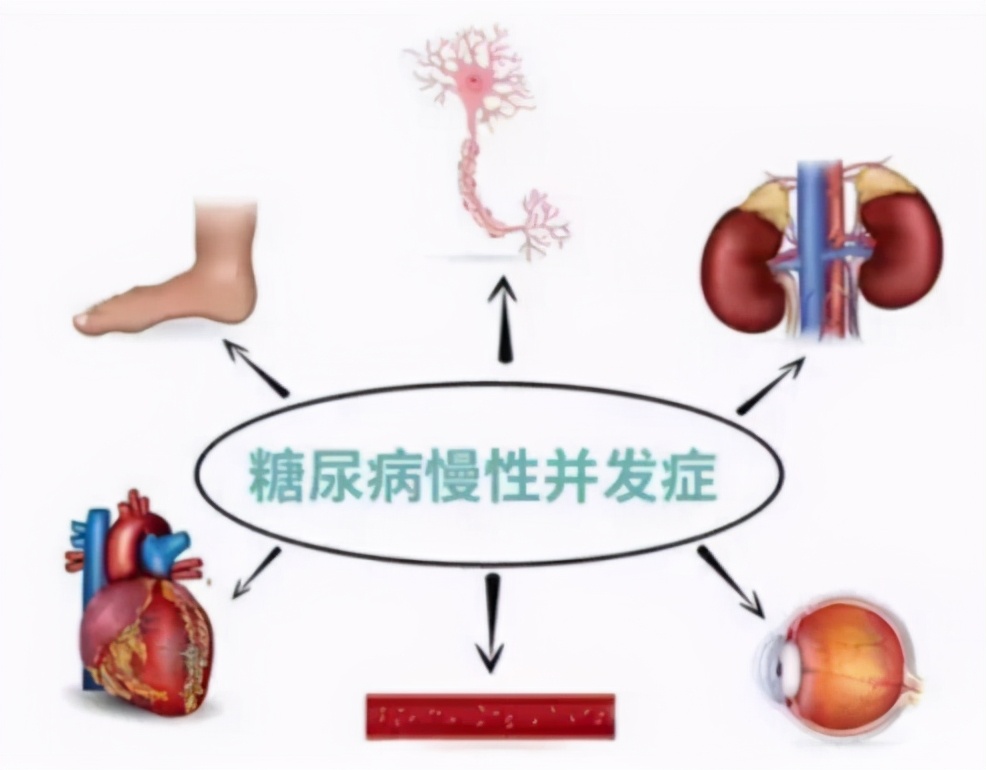 糖尿病神经病变,可选用这些药物治疗