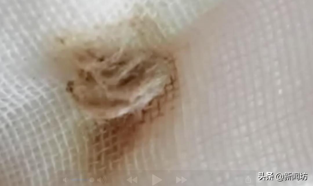 3岁女童出现少量出血是怎么回事,两岁女童少量出血