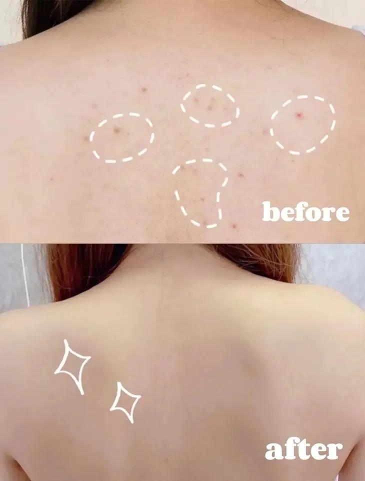 水压小增压花洒过滤,洗澡改用喷淋花洒节水