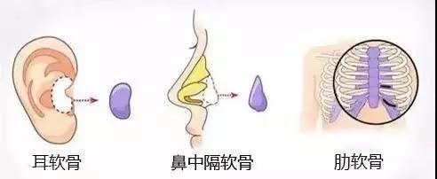 鼻子如何变漂亮,告诉你行业秘密