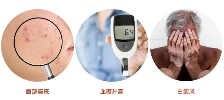 点阵激光治疗凹陷疤痕恢复过程,痤疮疤痕疙瘩可以激光治疗吗