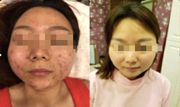 美白酵素皂大全,神奇的酵素有什么作用