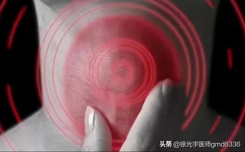 甲友的饮食如何,优甲乐如何调节tsh值